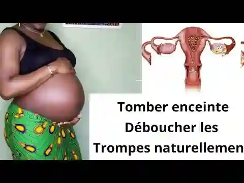 Traitement des Trompes Bouchées