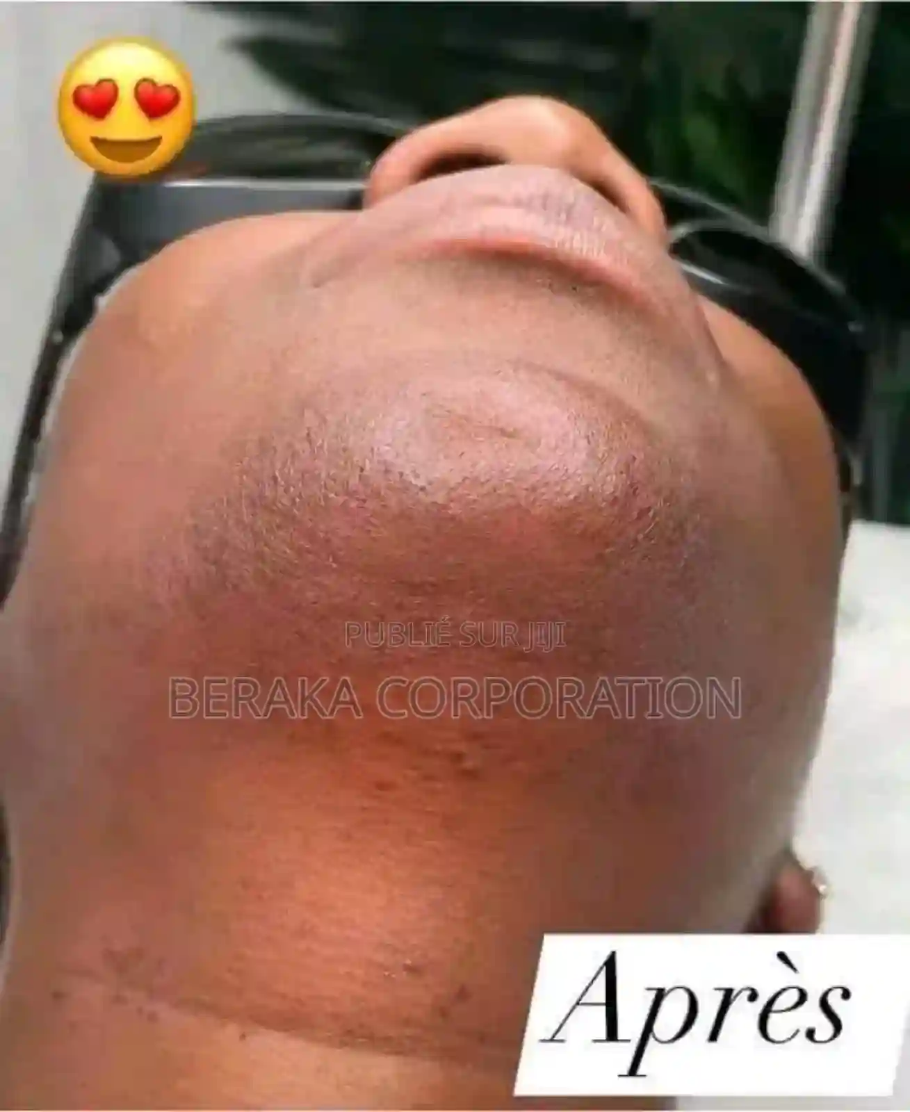 Savon Original Dudu Osun - Vue 1