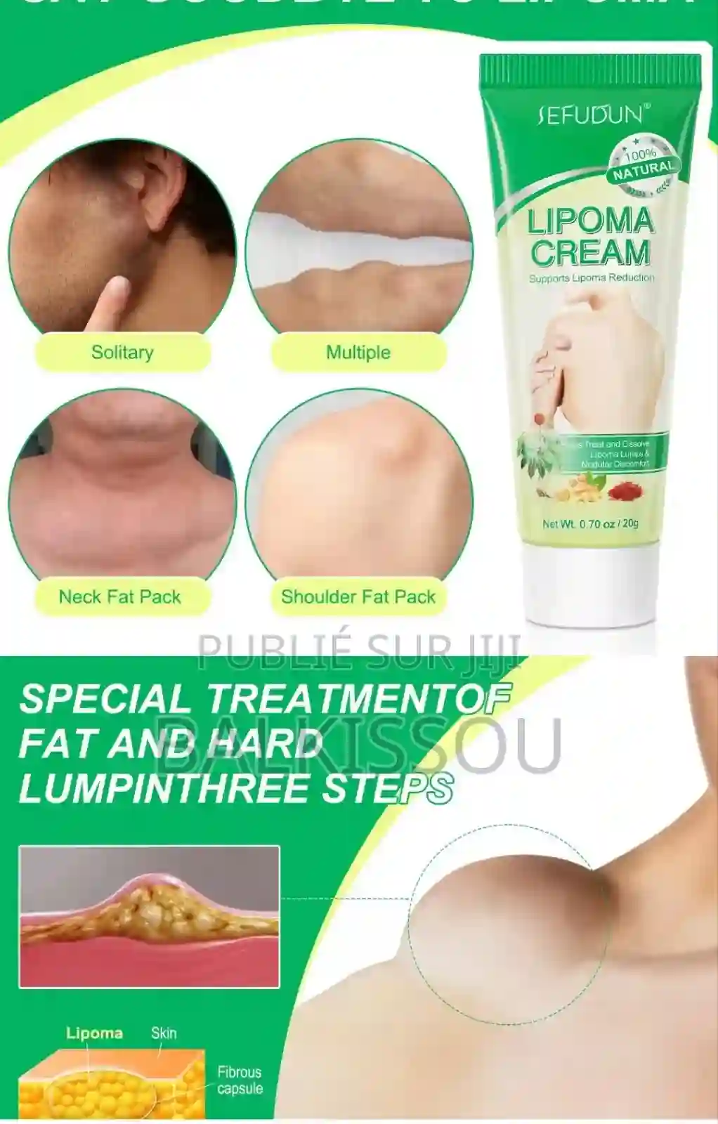 Crème Anti Lipome