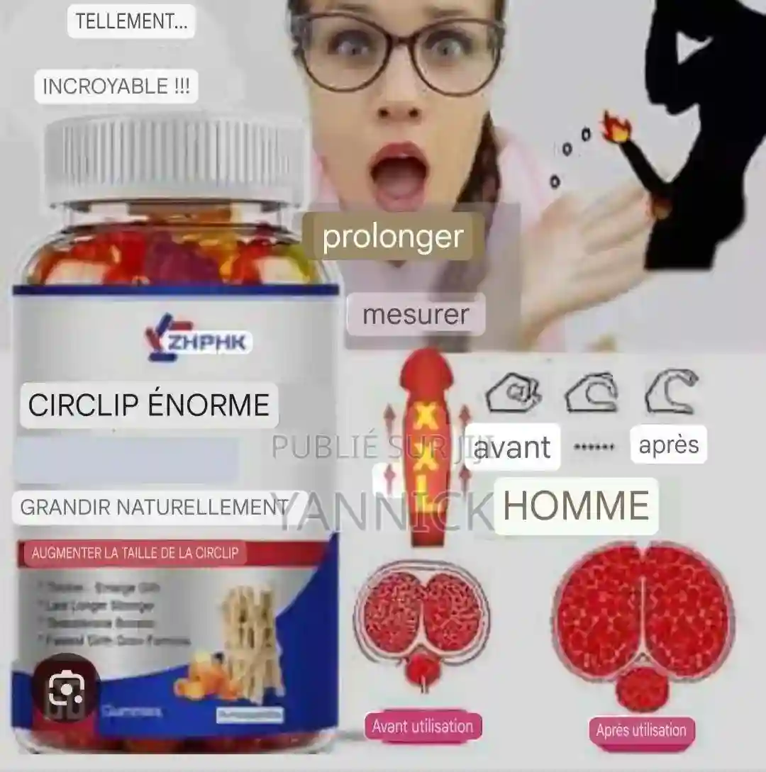 Massive Girth - Vue 1