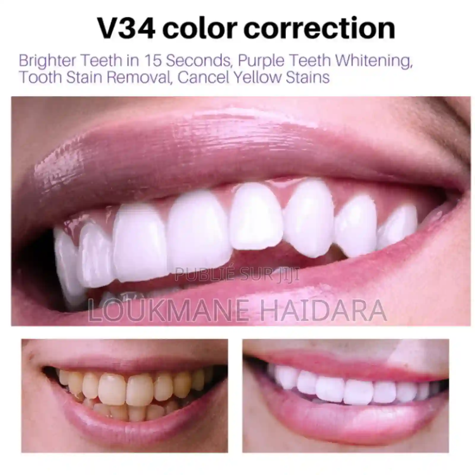 V34 Teeth Whitening Mousse - Vue 1