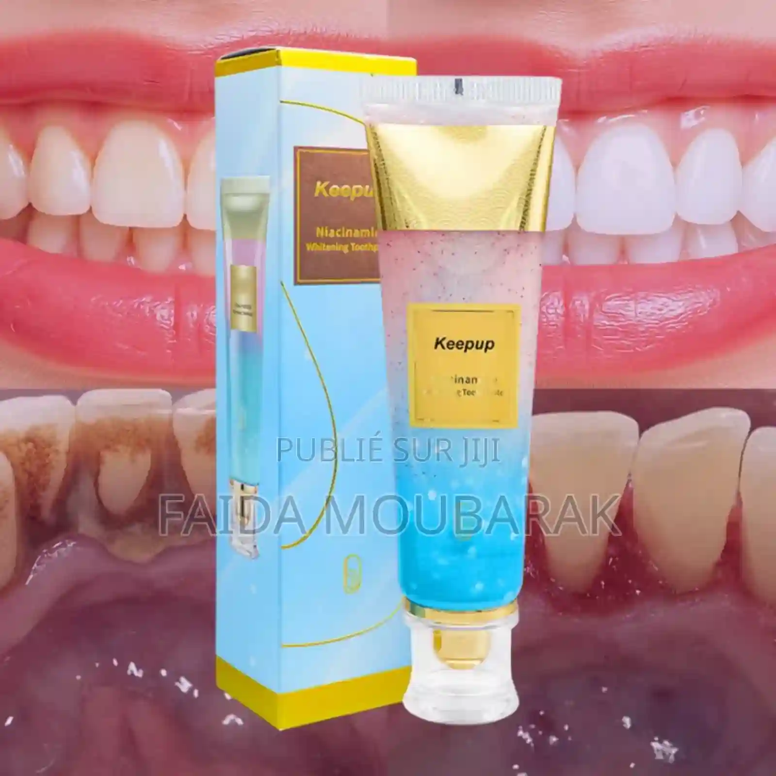 Keepup Niacinamide - Vue 2